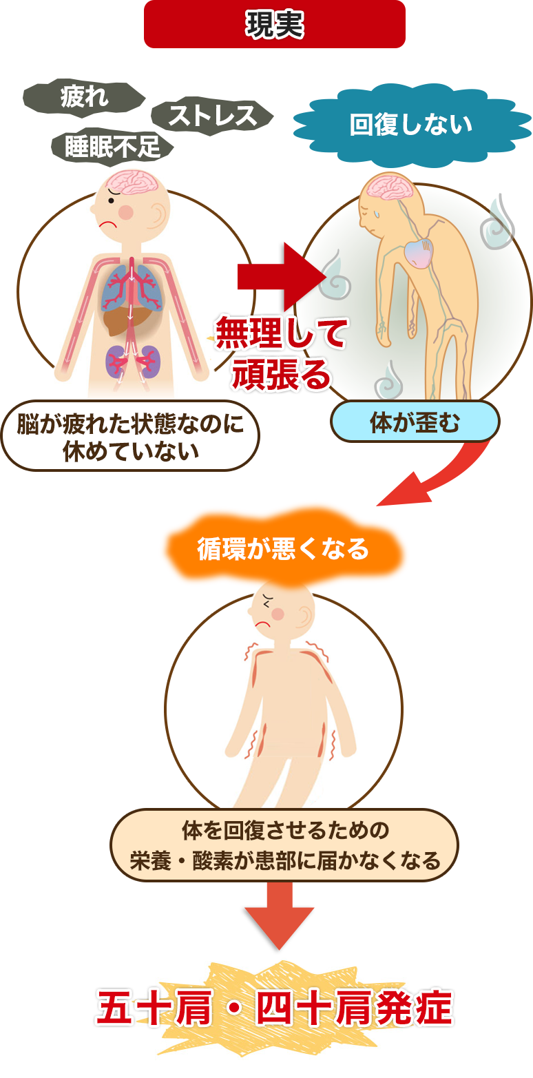 現実 間接的な原因