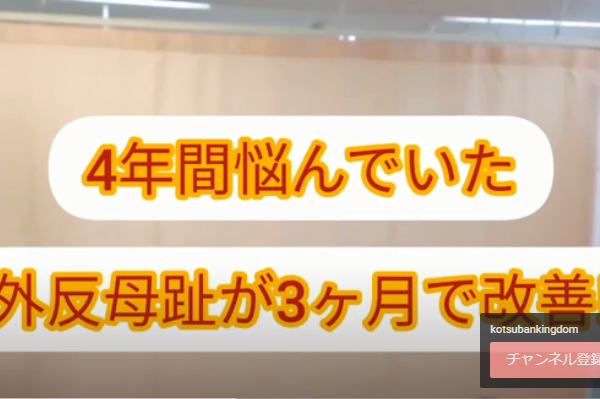 4年間悩んでいた外反母趾が3か月で改善した！