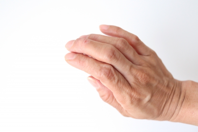 指の「屈筋腱損傷」その原因と対処法を解説します